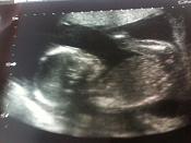 20 weeks.jpg
