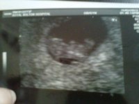 Baby peanuts scan 15.02.2012.jpg