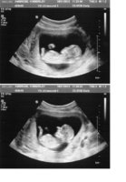 scan pic new baby.jpg