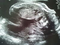 20wk4.jpg