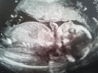 20wk2.jpg