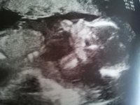 20wk3.jpg