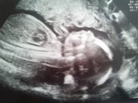20wk1.jpg