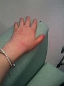 hand%20at%20hospital.jpg