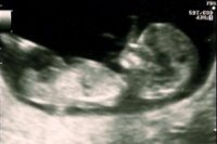 Baby Scan (1).jpg