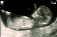 Baby Scan (2).jpg