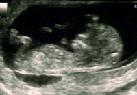 Baby Scan (3).jpg
