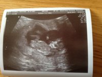 12 week scan.jpg
