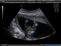 BABY OF KEELY_4.JPG