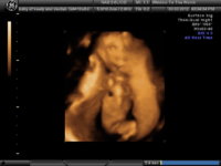 BABY OF KEELY_12.JPG