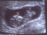 Baby Rogerson at 10weeks and 4 days.jpg