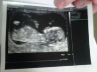 12 weeks 6 days.jpg