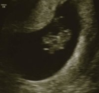 8 week scan.jpg