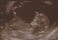 mimis 12 wk scan 004 copy.jpg