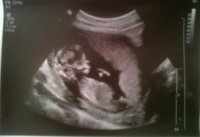 baby c! xxx.jpg
