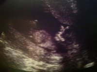 13 week scan .jpg