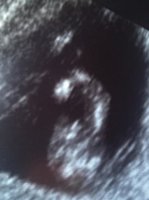 13 week scan with winky close up.jpg
