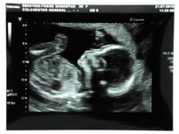 baby.jpg