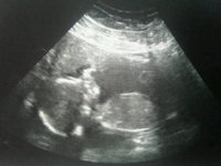 18 weeks.jpg