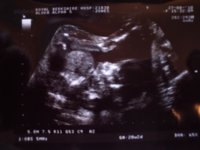 20 weeks Devon pic 1.jpg