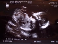 20 weeks Devon pic 2.jpg