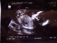 20 week Devon pic 3.jpg