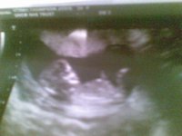 babba number 2, 12 weeks.jpg