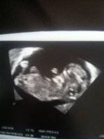 Wee F - 11 weeks.jpg