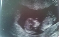 Baby scan.jpg