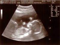 baby rogerson3.jpg