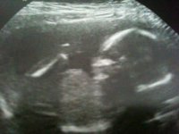 18 week scan.JPG