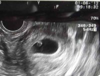 6weeks.jpg