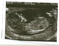 Baby Scans.jpg