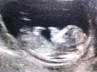 bub1.jpg