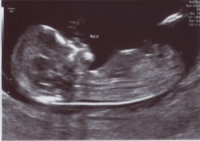 12wkScanmay2012.jpg