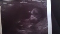 baby 12w 3days.jpg