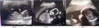 Baby Scans.JPG