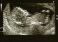 Babys1stscan.jpg