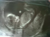 13wk 5days.jpg