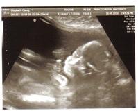 20 week scan.jpg