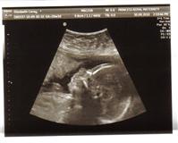 20 weeks 1.jpg