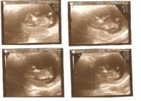 12 week scan pictures.jpg