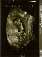Scan.jpg