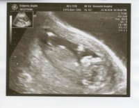 Baby Dalgarno.jpg