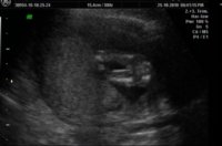 Between Legs1.jpg