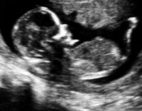 Baby#3.jpg