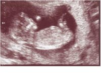 Baby Prime.JPG