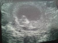 Baby bean.jpg