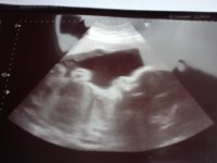 Lucy 30 weeks.jpg