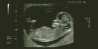 11 weeks 4 days.jpg